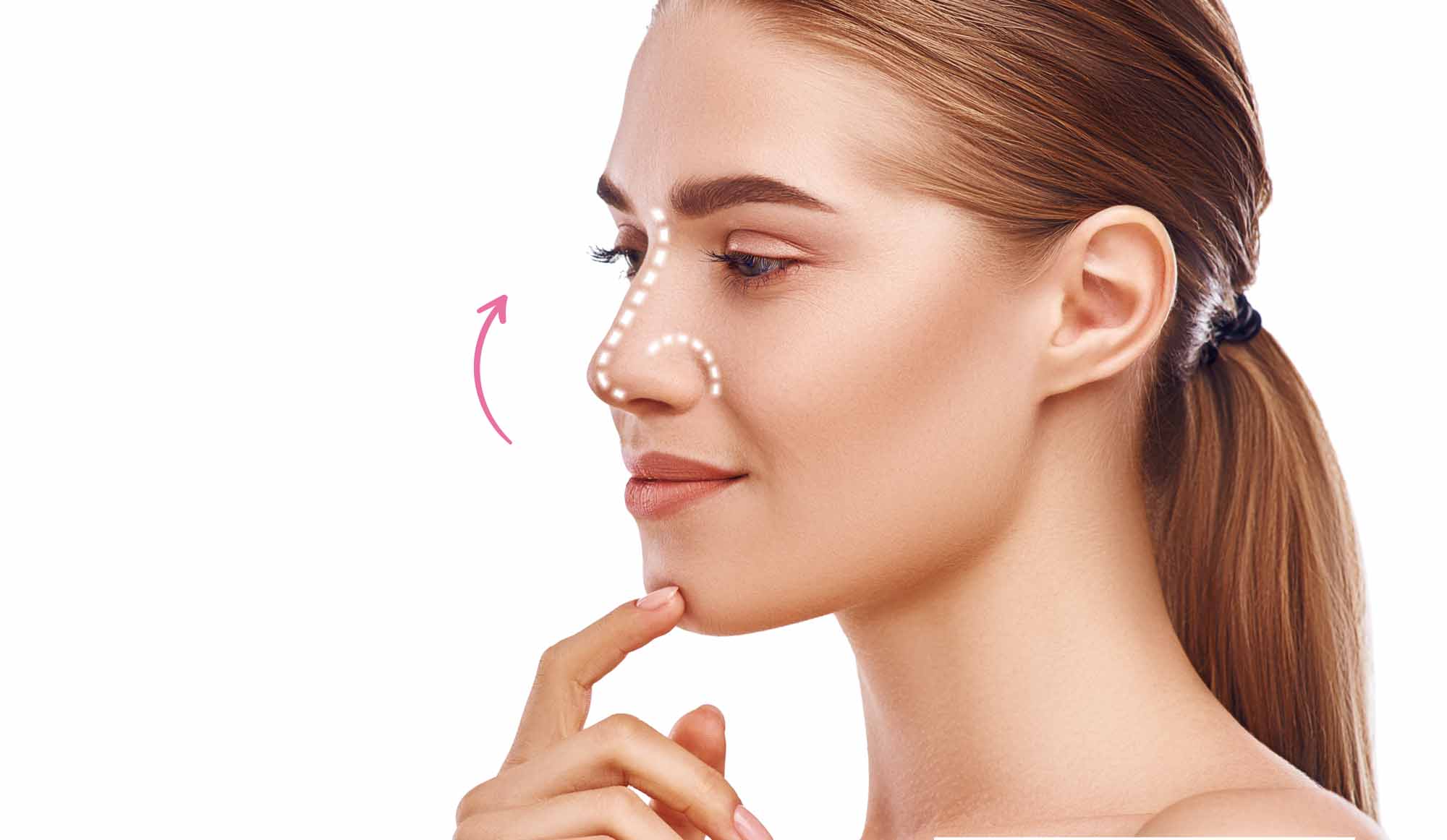 Estetica Elein Rinoplastia